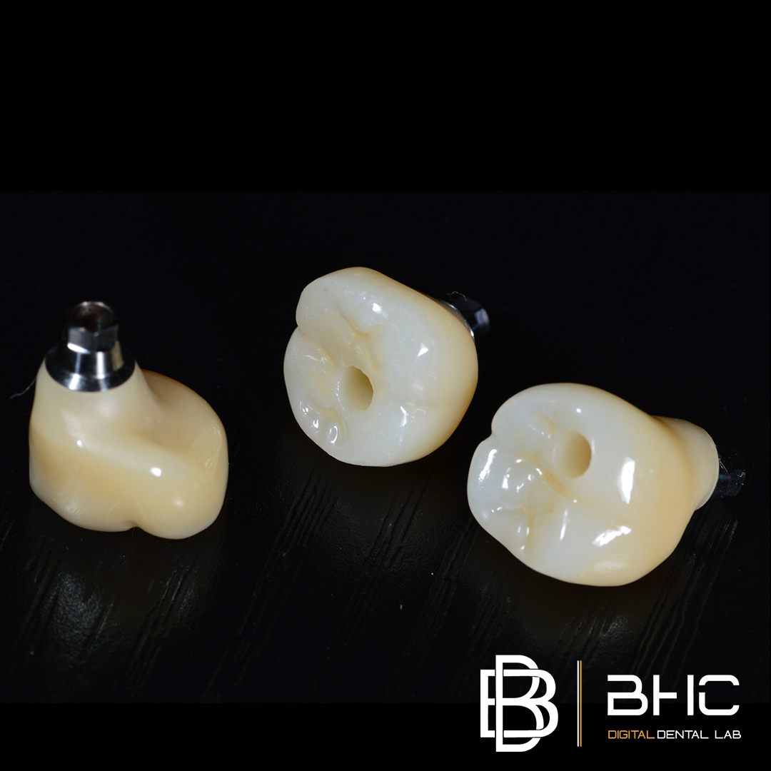 Implantes